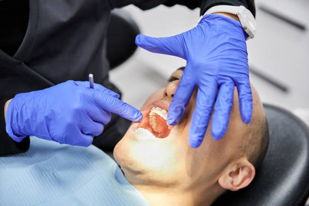 Best Emergency Root Canal Treatment in New London, TX